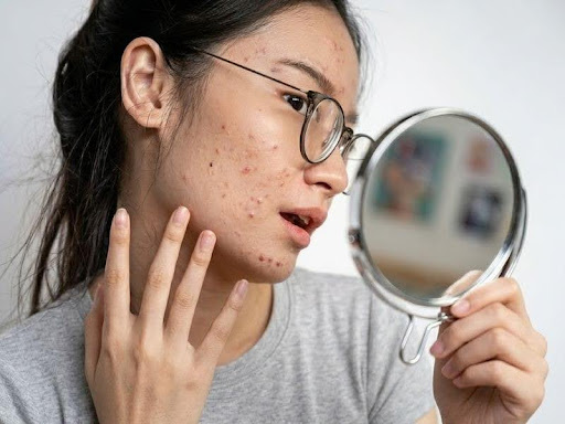độ tuổi dậy thì